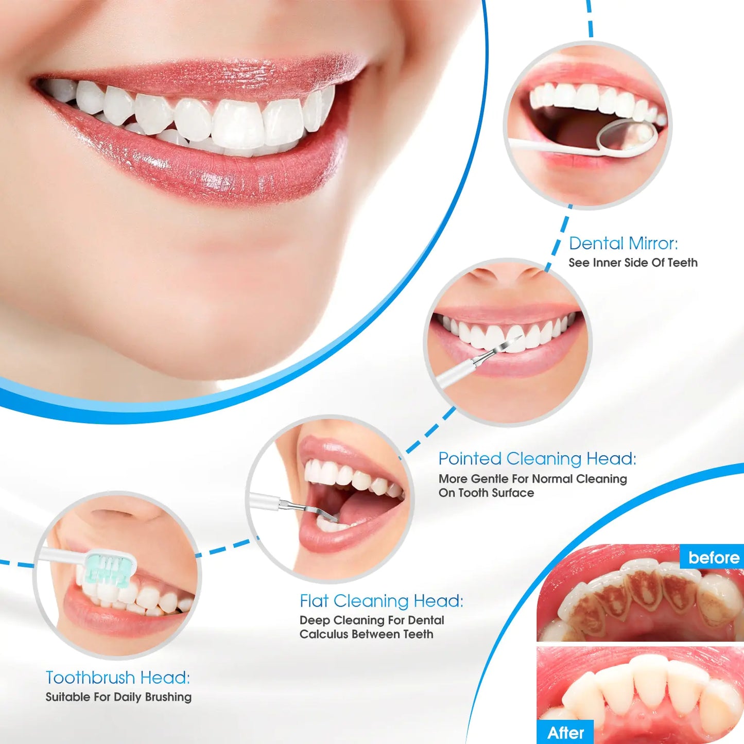 REMOVEDOR ELÉCTRICO DE CÁLCULOS Y CARIES DENTALES